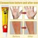 Face Cream Body Cream Anti-Itch Cream Chinese Herbal Cream Skin Repairing Cream for Face Body Healthy Skin Treatment Antifungal Cream Treatment Ointment Cream for Itchy Skin Moisturizing Skin Cream - Buy Online on GoSupps.com