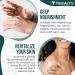 TreeActiv Rough & Bumpy Skin Lotion - Hyaluronic Acid Shea Butter & Vitamin E | 8 fl oz Moisturizer for Strawberry Legs & All Skin Types - Buy Online on GoSupps.com