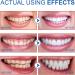 Dentifrice Ampoules Ampoule S rum Dentaire Teeth Whitening Essence Dentifrice Blancheur Whitening Essence Serum for Teeth limine la Mauvaise Haleine Nettoie les taches de dents (01) - Buy Online on GoSupps.com