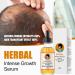  Dous Dous Essence Hair Oil - 2.11 oz Nourishing Hair Oil - Balance Oily Scalp Nourishing Spray relieves dry and flaky scalp revitalizes hair follicles - Buy Online on GoSupps.com