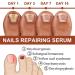 7 Days Nail Growth & Strengthening Serum - Repair Essence for Stronger Nails - 3PC Set - Buy Online on GoSupps.com