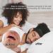 Top Anti-Snoring Solutions: Chin Strap & Mouthpiece for Peaceful Sleep Worldwide - Buy Online on GoSupps.com