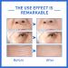 Botox Stock Solution Facial Serum Anti Aging Collagen Hydrating Serum Vitamin C Serum Vitamin E Salicylic & Amino Acids Botox Facial Serum Reduce Fine Lines Wrinkles Plump Skin - Buy Online on GoSupps.com
