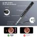Enjoyee Wireless Ear Wax Removal Kit with 1080P HD Ear Camera for iPhone, iPad & Android - Black - Buy Online on GoSupps.com