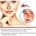 24PC Sun Protection Nose Patch - UV Protection for All Skin Types | Nose Guards for Glasses - Buy Online on GoSupps.com