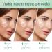 Dark Spot Remover for Face | Roller Corrector for Sun Age Spots & Melasma - Fast International Shipping - Buy Online on GoSupps.com
