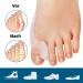 4-Piece Toe Spreader for Hallux Valgus - Silicone Ball Protection & Toe Separator Bandage - Pain Relief for Bunions - Buy Online on GoSupps.com