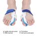 Bunion Splint Set - Hallux Valgus Corrector & Toe Separator for Foot Care | 6pcs Bunion Protector Cushions for Orthopedic Pain Relief - Buy Online on GoSupps.com