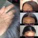 Frontal 13x4 Lace Straight HD Lace Frontal Transparent Lace Closure Human Hair Frontal Closure Pre Plucked with Natural Hairline Ear to Ear Natural Color Brazilian Hair for Women 16 Inch 16 Inch 13x4 Lace Closure - Buy Online on GoSupps.com