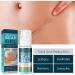Scar Cream for Fading Skin Scars & Wrinkles - Greasy-Free Gel, 50ml (2pcs) - Buy Online on GoSupps.com