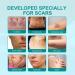 ScarRemove Advanced Scar Spray for All Types of Scars for Surgical Scars and Stretch Marks-20g (2PCS) - Buy Online on GoSupps.com