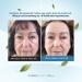 Serious Skincare Firm A Face XR Skin Tightener 3.2 oz - Reduces Fine Lines & Wrinkles - Instant Results - 1 Pack - Buy Online on GoSupps.com