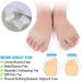 Haosem Gel Toe Spreader & Straightener - Orthopedic Pain Relief for Overlapping & Bunion Toes (2-Pair) - Buy Online on GoSupps.com