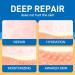 Medical Silicone Scar Sheets 8 Pack - Breast Scar Treatment for Post Surgery - Scar Removal & Reduction Supplies - Buy Online on GoSupps.com