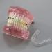 High-Quality Lhlyl-DP Dental Teeth Model for Orthodontic Brackets Simulation | Metal & Ceramic Self-Ligating Bracket Demonstration - Buy Online on GoSupps.com
