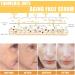 Turmeric Serum Dark Spots 30 ml Spot Corrector Face & Body Anti Aging and Wrinkle Face Serum Reduces Hyperpigtation Age Spots Sun Spot Improve Skin Tone Moisturize Brighten All Types - Buy Online on GoSupps.com