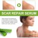 Goopgen Advanced Scar Repair Serum - Medical Grade, Lighten Acne, Pregnancy & Surgery Scars - 90ml (3pcs) - Buy Online on GoSupps.com