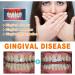 Shop Ampoule Tooth Repair & Enamel Whitening Serum - 2PC Gums Repair Essence for Healthy Smile - Buy Online on GoSupps.com