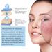 10ml Gla-mory Micro Infosion System for Lips Gla-mory Micro System for Face Facial System with Serum Hyaluronic Acid Serum for Face Anti Aging Serum for Face Hydrating Serum Collagen Serum for Face - Buy Online on GoSupps.com