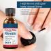 Fungal Nail Treatment Premium Fungal Nail Eliminator Toenail Treatment Extra Strong Nail Repair Anti fungus Nail Repair and Strengthen Fix & Renew Damaged Broken Nails - Buy Online on GoSupps.com