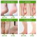 Exfoliating Foot Mask - 2 Pairs of Cornea Socks for Men & Women | Effective Foot Care for Tender Feet | Vera Green - Buy Online on GoSupps.com