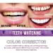 KLYso Professional Teeth Whitening Toothpaste for Stain Removal & Oral Care(3PCS) - Buy Online on GoSupps.com