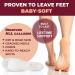 Own Harmony Electric Horn Skin Remover - Professional Pedicure Tool for Hard Skin & Cracked Heels - USB Rose Gold - Buy Online on GoSupps.com