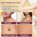 Body Firming Oil Glow-Remedy body oil for women Body Oil After Shower Tightening&Hydrating Treatment for Arms Legs Stomach&Body Natural Firming Oil for Dry Skin Non-Greasy Body Serum-(4.06 Oz) W RED-A - Buy Online on GoSupps.com
