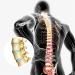 Decompression Belt for Lumbar Support | Lower Back Pain Relief & Sciatica Treatment - Yellow - Buy Online on GoSupps.com
