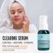 The Skin Shark Breakout Clearing Serum (50ml) - Hydrating Facial Serum With 5Beta-Scymnol For Blemish Prone Skin - Controls Facial Skin Oils that may be the cause of Acne - Suitable For Sensitive Skin - Buy Online on GoSupps.com