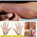 Organic Herbal Tinea Corporis Cream for Skin Relief - 3pcs Set for Eczema, Psoriasis & Itching - Buy Online on GoSupps.com