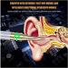 Buy SMSOM Ear Wax Removal Camera - Waterproof Earwax Tool with WiFi 6 LED Lights for Adults & Kids - International Shipping Available - Buy Online on GoSupps.com