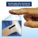 Buy Brace On EZ Finger Splint Kit - 44 Piece Adjustable Hand Injury Support | International Shipping Available - Buy Online on GoSupps.com