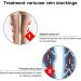 Hohxfype Venenstrasse Compression Stockings - Non-Fading Highly Elastic Leg Pressure Reduction - Buy Online on GoSupps.com