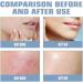 Gla-Mory Micro-Infusion System for Lips Gla-Mory Micro System for Face Hyaluronic Acid Serum Gla-Moryfacial System with Hydrating Serum Smooth Face Serum for Women Skincare Anti Aging Serum for Face - Buy Online on GoSupps.com
