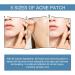 Buy Ikasus Acne Patch - 80 Hydrocolloid Pimple Dots with Tea Tree & Calendula Oil | Invisible Acne Absorbing Covers - 5 Sizes for Face & Body - International Shipping Available - Buy Online on GoSupps.com