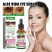 Eye Serum for Dark Circles & Bags | Hyaluronic Acid Anti-Aging Eye Cream for Men & Women (2PC) - Buy Online on GoSupps.com