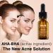 SKIN LABO SkinLabo Active Serum Aha + Bha Eliminates Surface Dead Cells Skin Perfecter with Exfoliating and Purifying Action 15 ml (Old Version) - Buy Online on GoSupps.com