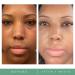 Replenix Brightening Eye Cream - 0.5 oz - Dark Circle Treatment for Under Eye Puffiness - Buy Online on GoSupps.com