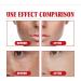 Melasma Treatment for Face Removes Facial Melasma Dark Spots Spot Cream Hyperpigmentation Treatment Sun Spots and Melasma Freckle Remover Remove Dark Spots Pigmentation Removal Cream for Face - Buy Online on GoSupps.com