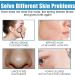 Repairing Face Cream Smoothing Day Cream Anti-Redness Moisturising Cream Firming Face Cream for Sensitive Skin Vitamin B5 Cream Against Acne Brightening & Skin Repair - Buy Online on GoSupps.com
