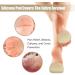 Confifill Metatarsal Pads - Forefoot Cushions for Metatarsalgia Relief - Size L (W 8-10, M 9-11) - Buy Online on GoSupps.com