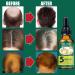 Ginger Hair SolutionNourishing Essential Oil for Hair Growth 30ML natural hair essence for damaged hair nourishes your hair Fukamou - Buy Online on GoSupps.com
