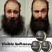 Waking Forest Beard Balm Kit for Men | All-Natural Thicker Beard Growth Butter & Softener | Ultimate Moisturizer Beard Growth Kit - Buy Online on GoSupps.com