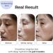 Petite Pluie 50 PCS Wrinkle Patches for Face with Collagen, Hyaluronic Acid & Peptides - Korean Face Lift Tape - Made in Korea - Buy Online on GoSupps.com