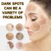 Brightening Repair Face Cream - Face Cream for Women - Face Moisturiser for Dark Spot Correcting - Moisturizing and Anti-Blemish Spot Cream - Buy Online on GoSupps.com
