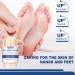 Moisture Level Urea 42% Foot Cream Cracked Heel Repair Cream for Feet And Hand Foot Cream for Cracked Heels And Dry Skin Foot Care Cream Deep Hydrating & Smooth Dull Skin Remover Foot Cream - Buy Online on GoSupps.com