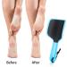 4 Pieces U-Shaped Double-Sided Foot File Callus Remover Set - Exfoliates and Removes Dead Skin - 4 Colors - Buy Online on GoSupps.com