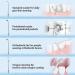 YUNERFEEL Cordless Water Flosser with Telescopic Tank | Rechargeable & Portable Oral Irrigator - IPX8 Waterproof, 3 Modes for Teeth, Braces & Bridges - White - Buy Online on GoSupps.com