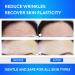 SILKDERMIS Forehead Wrinkle Patches - 12 Pack Anti Wrinkle Patches with Aloe, Collagen & Vitamin E for Forehead Wrinkles Treatment - Buy Online on GoSupps.com